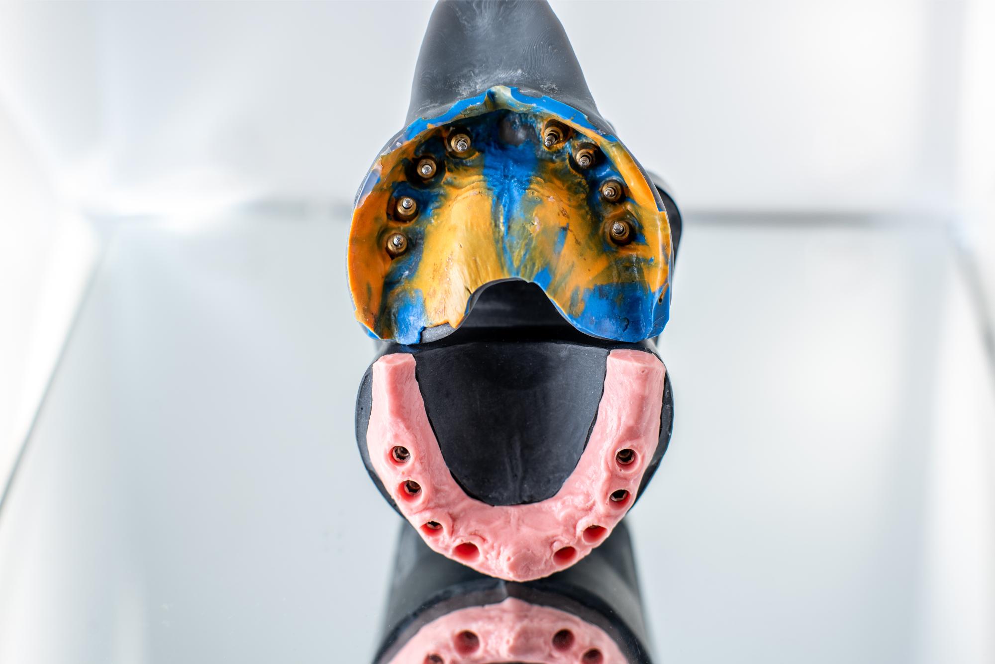 jaw-impressions-for-implants-modeling-2023-11-27-05-36-01-utc boca raton fl cosmetic dentist